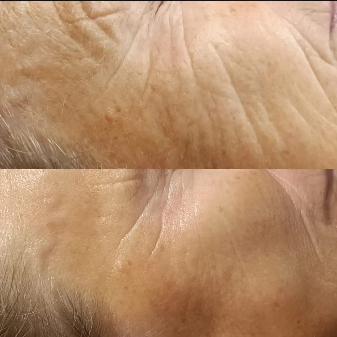 Résultat Visible Age Reverse 2